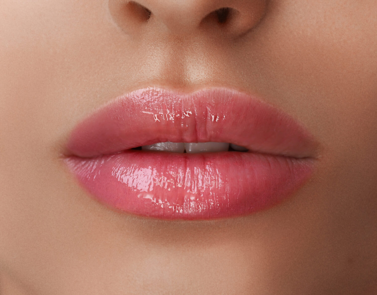 Powiększenie ust kwasem hialuronowym